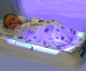 Фототерапия: уф лампа от желтушки для новорожденного